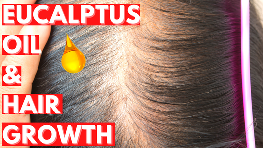 eucalyptus oils for dandruff and hair growth