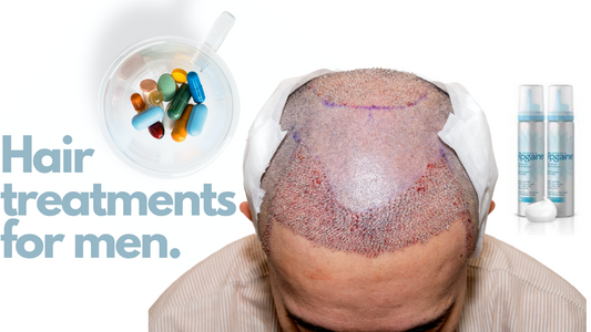 Receding Hairlines and Baldness :  Treatments for Hair Loss