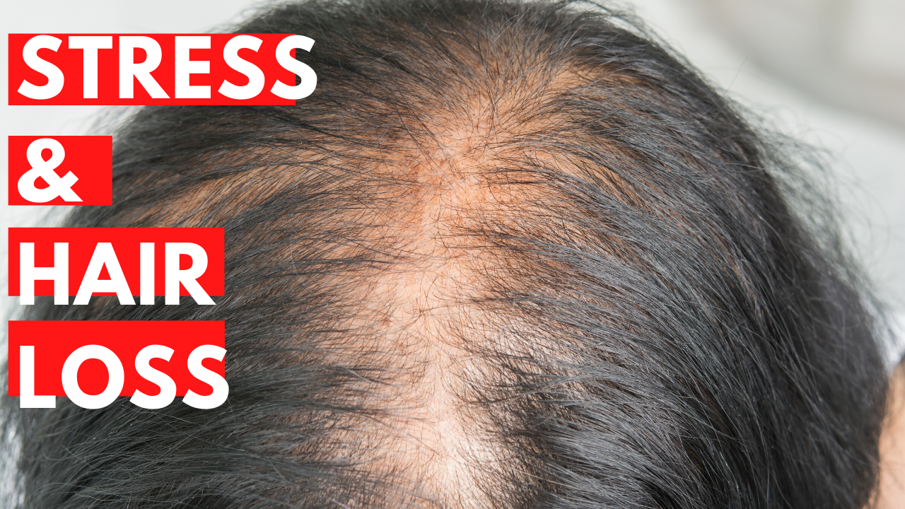 Oily Scalp Hair Loss: Causes, Symptoms and Prevention| H&S India