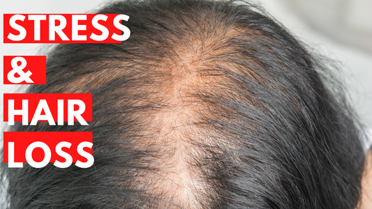 Stress and Hair Loss