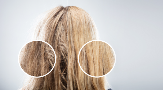 Can bleaching cause hair loss? 