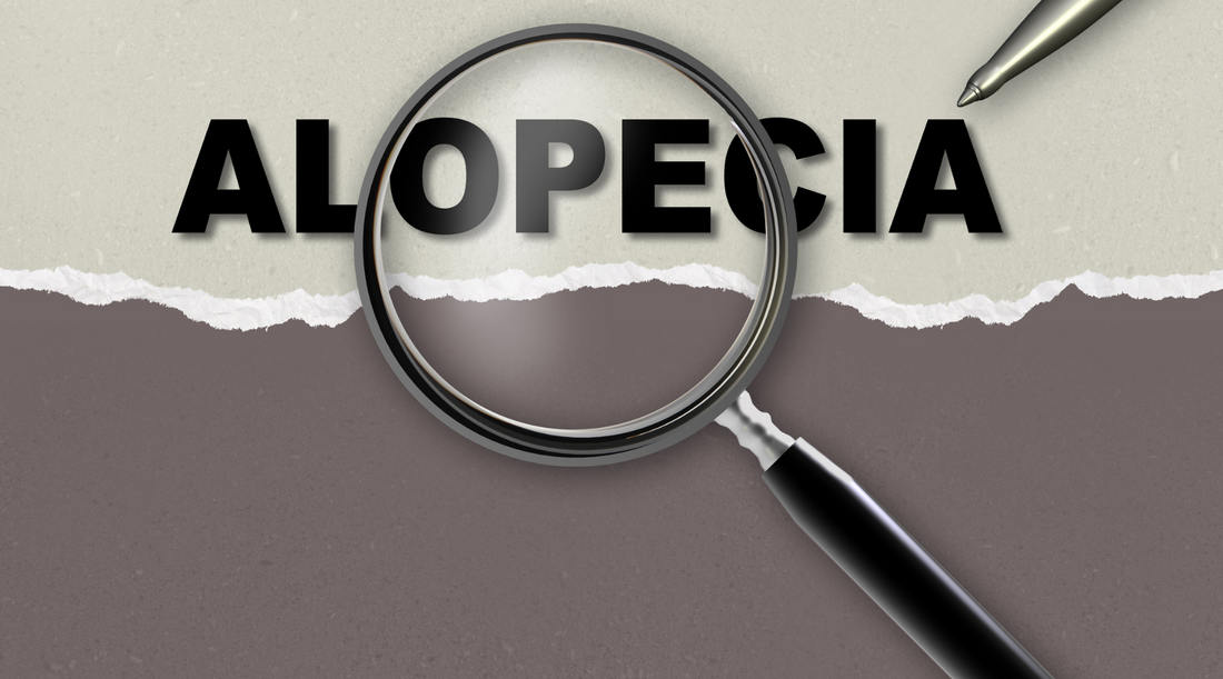 Everything you need to know about Alopecia Areata