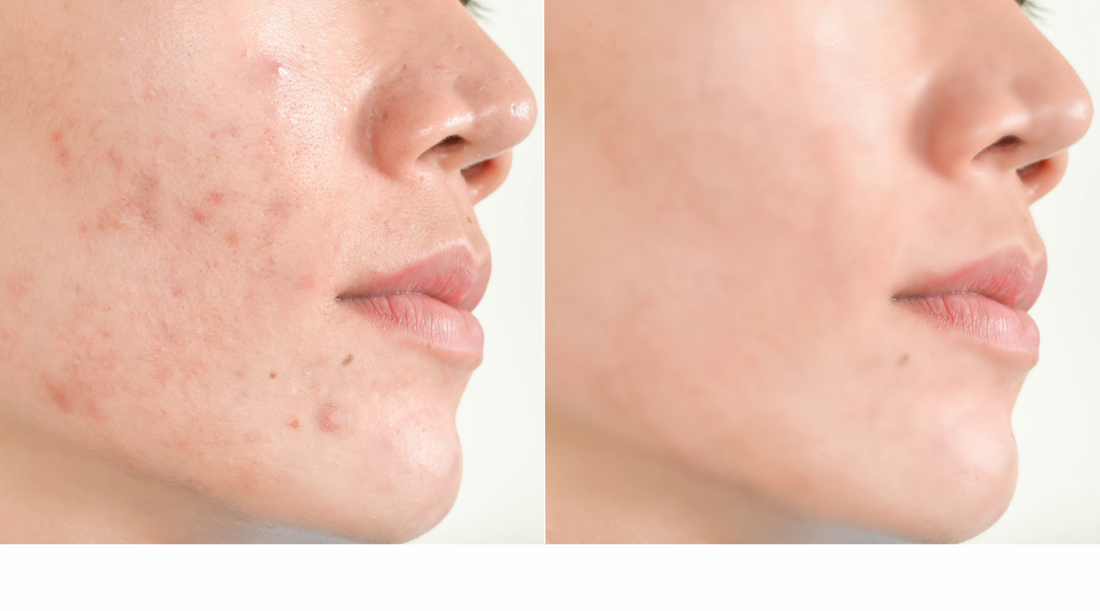 How to identify early stage skin problems: from acne to signs of serious illness-It Really Works Vitamins