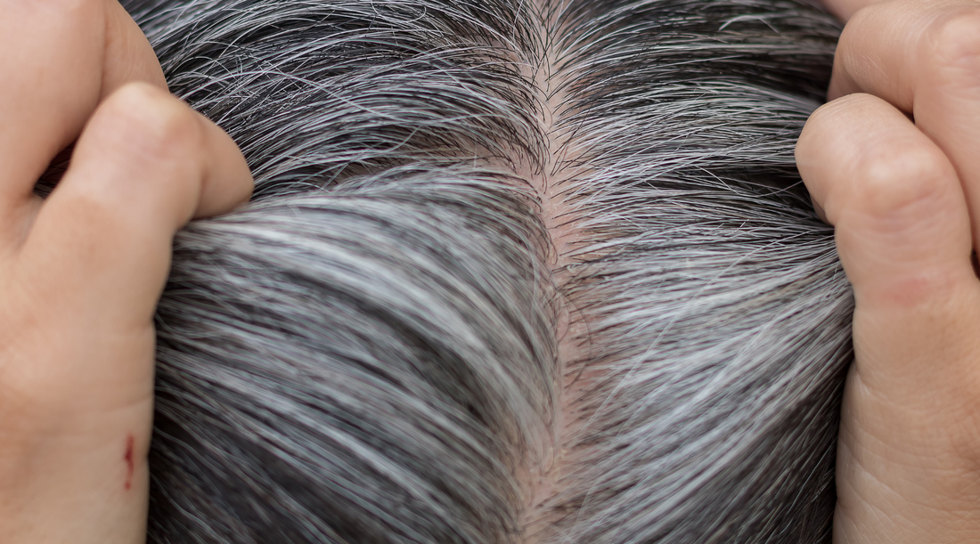 Best Vitamins for Hair Growth