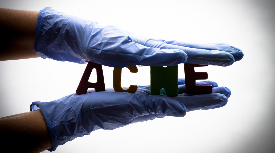 Five myths about the causes of acne