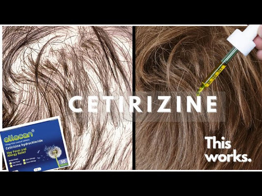 Cetirizine