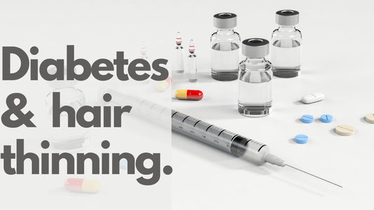 Does Diabetes Cause Hair Loss and What Can You Do?