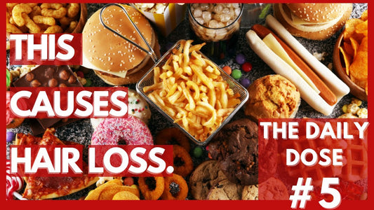 Foods that cause hair loss