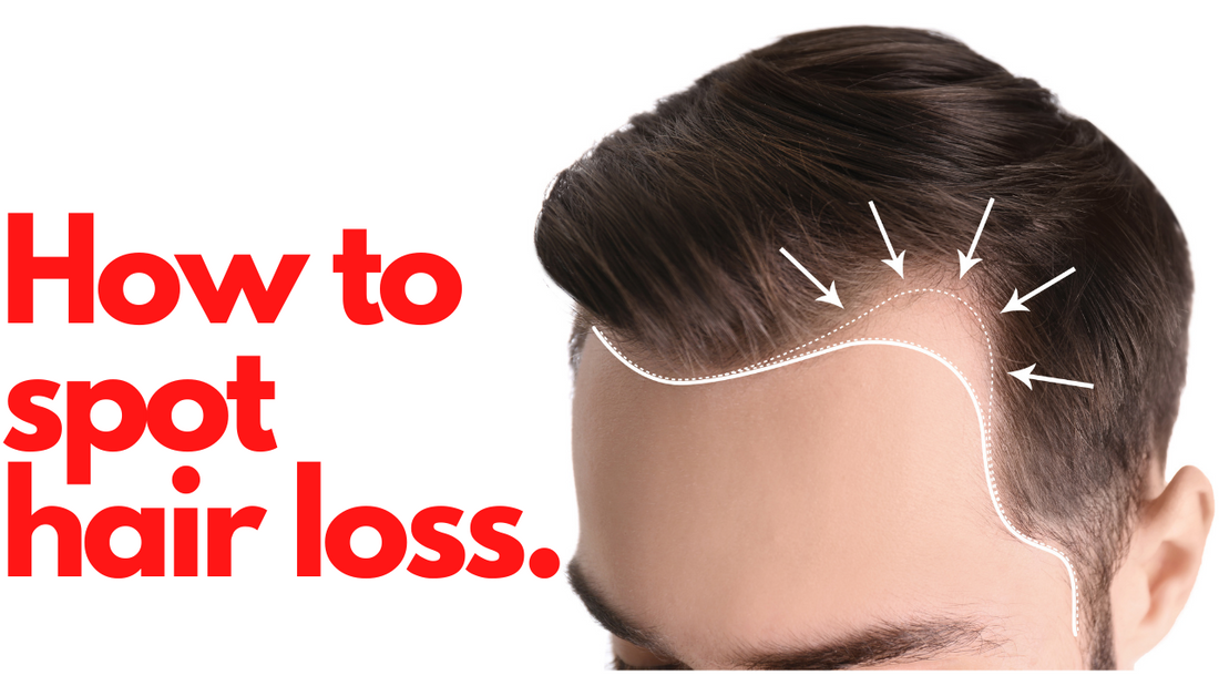 How to Spot Hair Loss