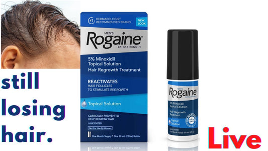 Still Losing Hair While Using Minoxidil? THIS IS WHY