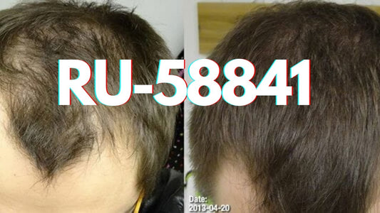 RU58841