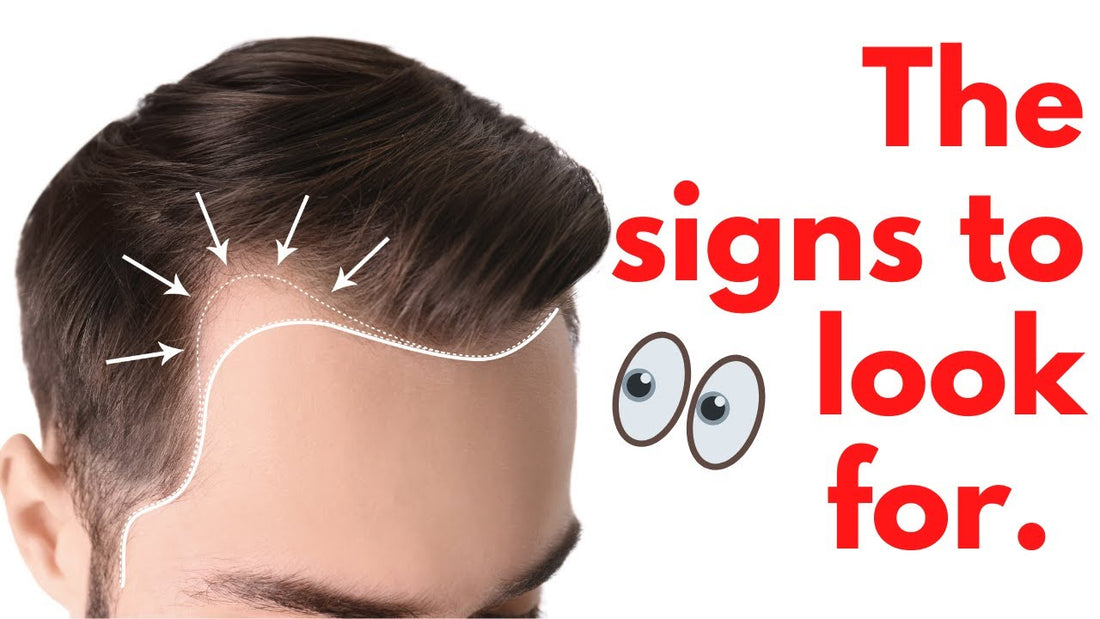 This is how to spot hair loss