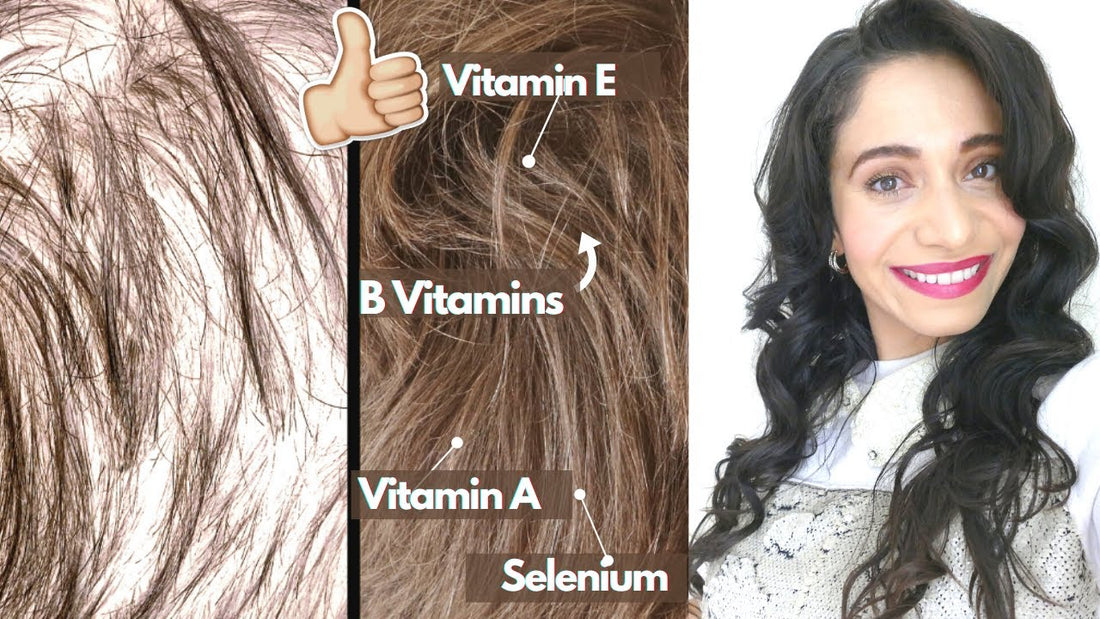 Do vitamins help your hair grow