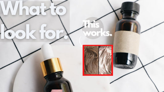 Essential Oils For Hair Loss: 5 Things To Look Out For